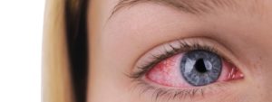 Uveitis Treatment in Portland, OR | The Eye Clinic PC