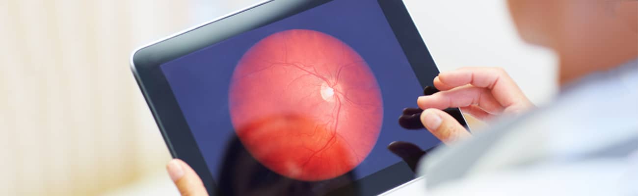doctor viewing Macular degeneration effects on a tablet